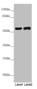 Polyclonal Rabbit anti-Human PACSIN2 Antibody (IHC, WB)