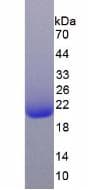 Rat RSPO1 / RSPO Protein (Recombinant His, N-Terminal)