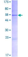 Human SLC25A52 Protein (Recombinant GST)