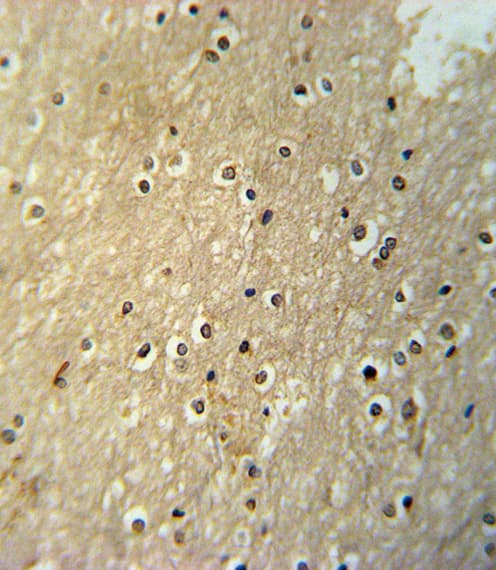 Polyclonal Rabbit anti-Human PAX6 Antibody (aa352-380, IHC, IF, WB)