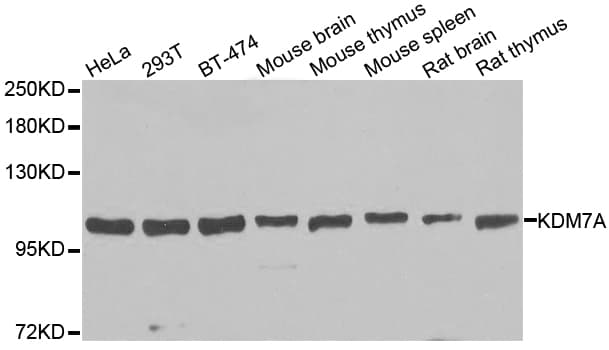 KDM7A / JHDM1D Antibody