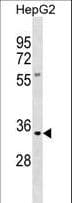 KLK9 / Kallikrein 9 Antibody (aa1-30)