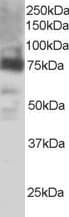 PTGS2 / COX2 / COX-2 Antibody (aa592-604)