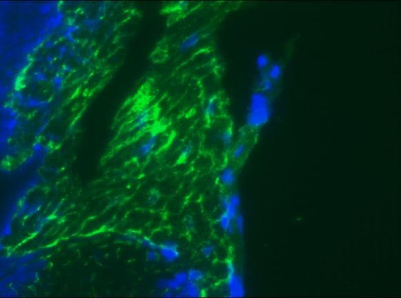 IHC-plus™ DES / Desmin Antibody