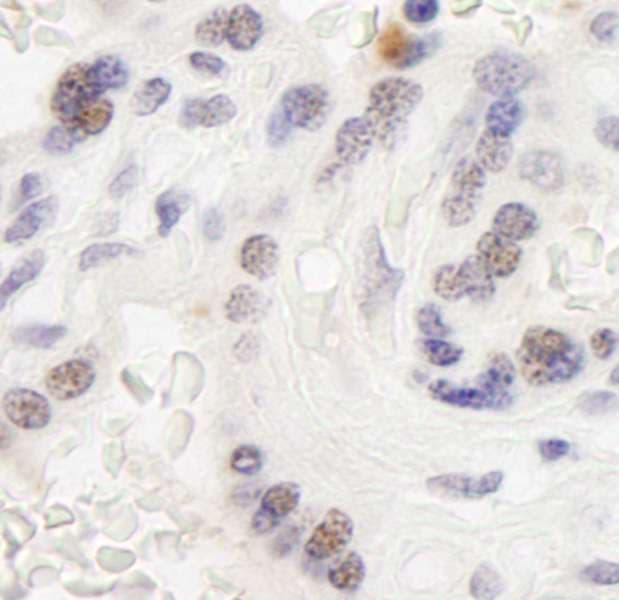 BAZ1B / WSTF Antibody (aa1-50)