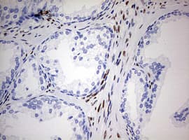ZEB1 / AREB6 Antibody (aa1-350, clone OTI3G6)