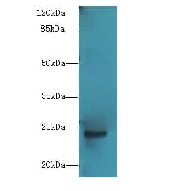 MRPL22 Antibody