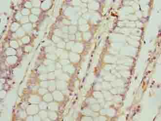 Polyclonal Rabbit anti-Human FSIP1 Antibody (IHC)