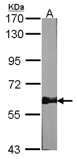 Polyclonal Rabbit anti-Human PRKAA2 / AMPK Alpha 2 Antibody (aa29-510, IHC, WB)