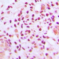 Polyclonal Rabbit anti-Human MUTYH / MYH Antibody (Internal, IHC, IF, WB)