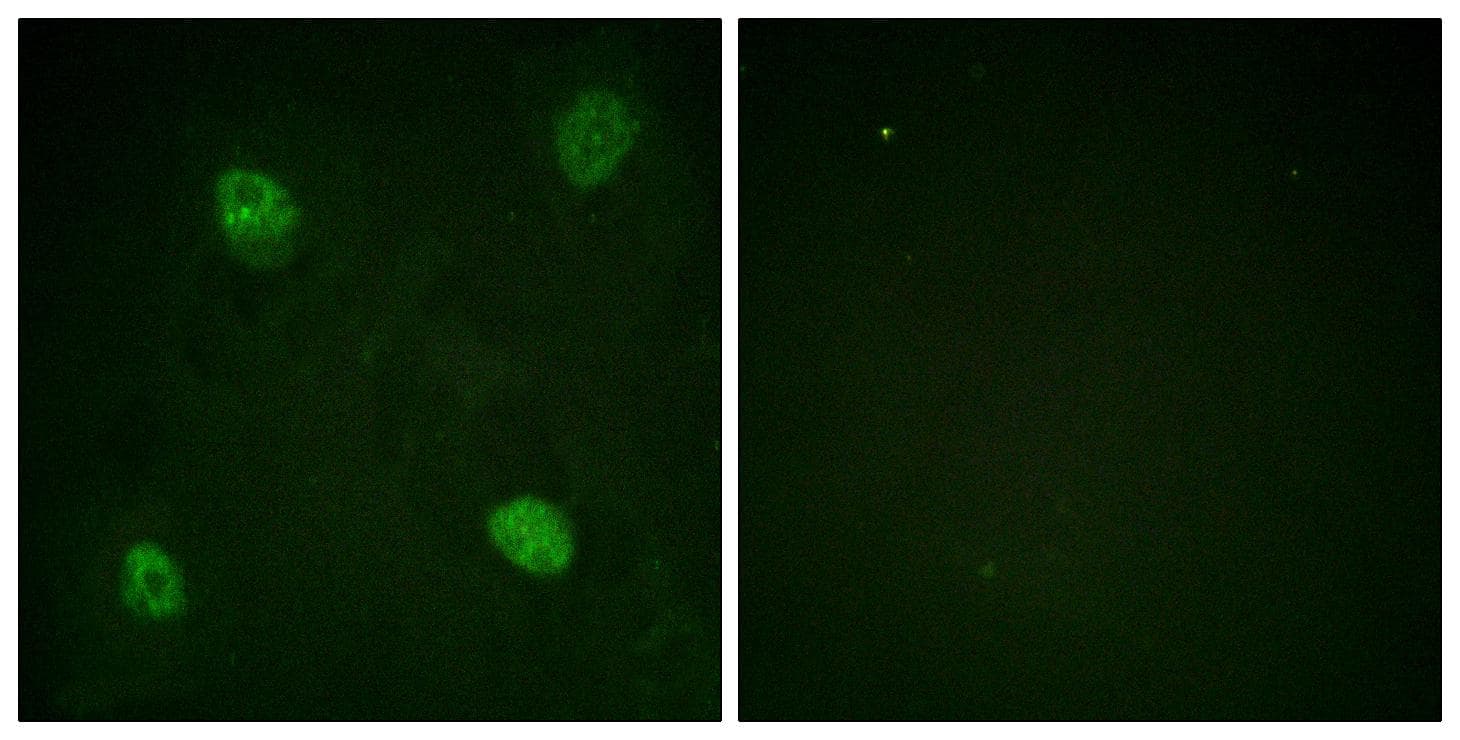 HNRNPD / AUF1 Antibody (phospho-Ser83)