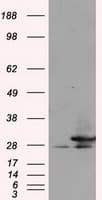 RPA2 / RFA2 / RPA34 Antibody (clone OTI4C3)