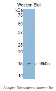 TXN / Thioredoxin / TRX Antibody (aa1-105)