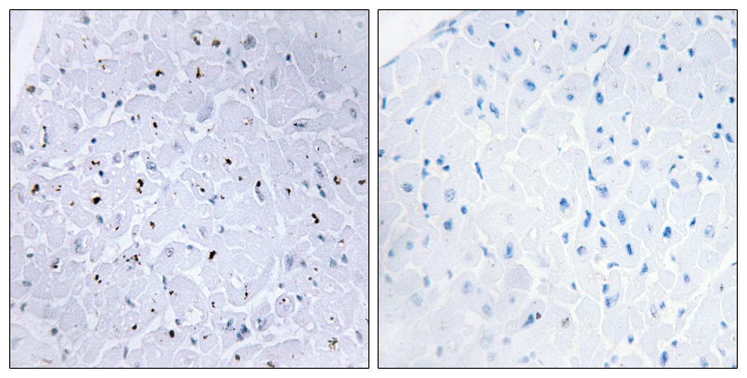 Polyclonal Rabbit anti-Human TP53BP1 / 53BP1 Antibody (phospho-Ser6, IHC, WB)