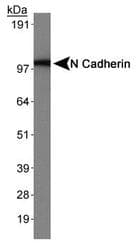 CDH2 / N Cadherin Antibody (Cytoplasmic Domain, clone 13A9)