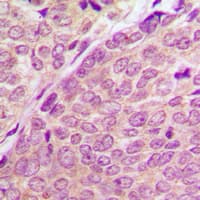 PAK1 + PAK2 + PAK3 Antibody (phospho-Ser144/Ser141/Ser139)