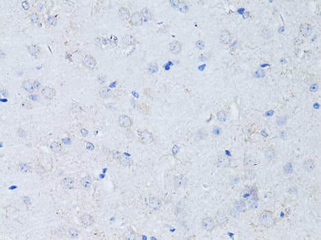 RYR2 / Ryanodine Receptor 2 Antibody