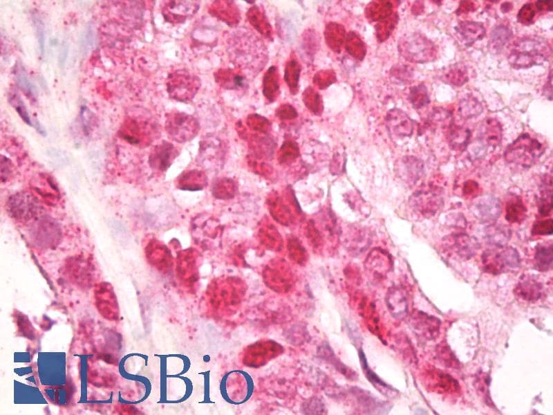 IHC-plus™ Polyclonal Rabbit anti-Human CNOT4 / CLONE243 Antibody (aa50-100, IHC, WB)