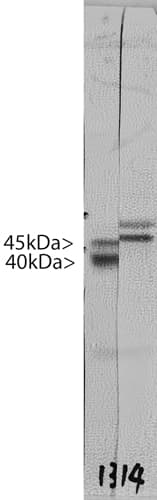 DCX / Doublecortin Antibody (clone 3E1)