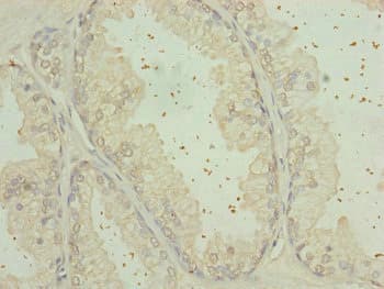 RPP25L / C9orf23 Antibody
