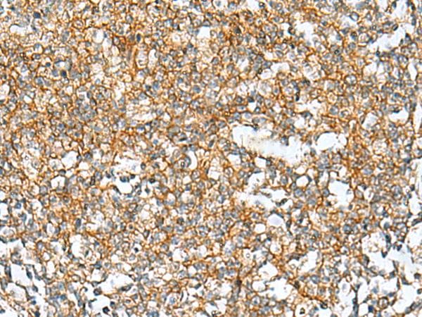 Polyclonal Rabbit anti-Human RAB13 Antibody (IHC)