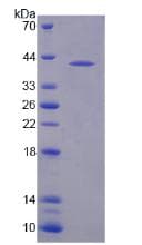Human NAT8L Protein (Recombinant His, N-Terminal)