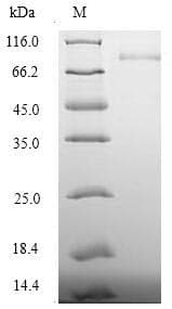 Human DSG3 / Desmoglein 3 Protein (Recombinant 6His-SUMO, N-terminus)