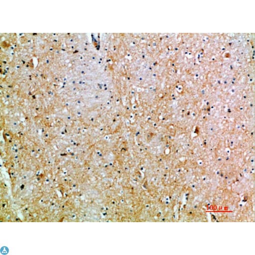 TSPAN7 / CD231 Antibody