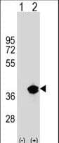 IHC-plus™ Polyclonal Rabbit anti-Human PPT1 / CLN1 Antibody (aa189-217, IHC, WB)