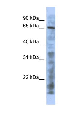 KAT5 / TIP60 Antibody (aa107-156)