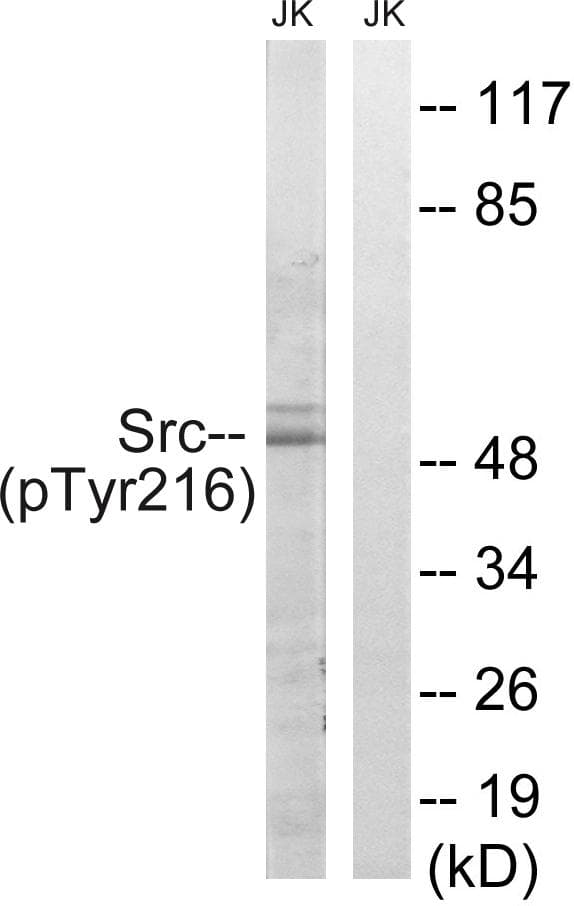 SRC Antibody (phospho-Tyr216)