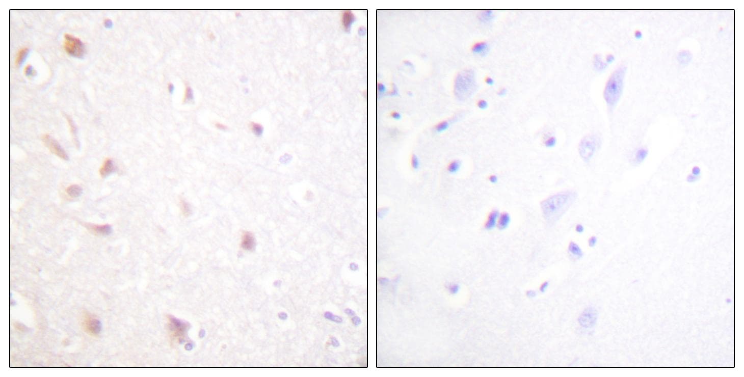 Polyclonal Rabbit anti-Human NIFK / MKI67IP Antibody (Ab-234, IHC, IF)