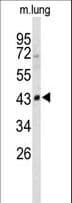 SMPD2 Antibody (aa9-35)