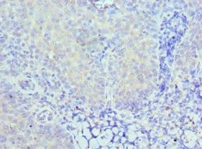 Polyclonal Rabbit anti-Human CARD8 / Cardinal / TUCAN Antibody (aa1-200, IHC)
