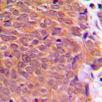 Polyclonal Rabbit anti-Human CFL1 / Cofilin Antibody (phospho-Ser3, IHC, IF, WB)