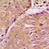 Polyclonal Rabbit anti-Human STMN1 / Stathmin / LAG Antibody (N-Terminus, IHC, IF, WB)