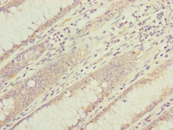 Polyclonal Rabbit anti-Human DYNC1I1 Antibody (IHC, WB)