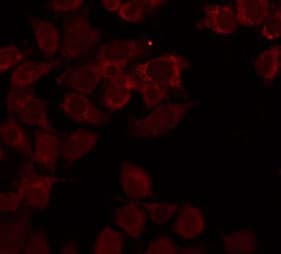Tyrosinase Antibody