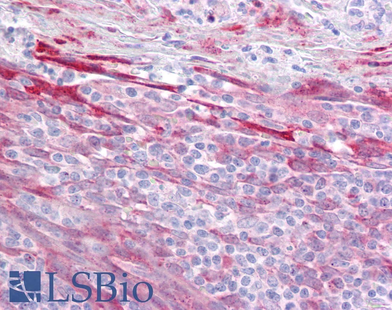 IHC-plus™ Polyclonal Rabbit anti-Human MRE11A / MRE11 Antibody (IHC, IF, WB)