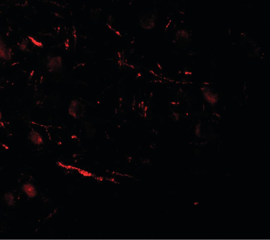 IHC-plus™ VPS13B Antibody