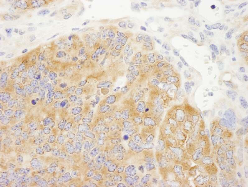 Polyclonal Rabbit anti-Human DDX6 Antibody (aa1-50, IHC)