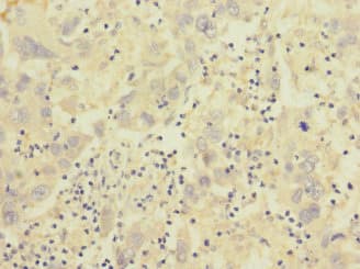 Polyclonal Rabbit anti-Human ITGB7 / Integrin Beta 7 Antibody (IHC)