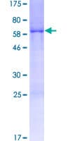 Human CCDC106 Protein (Recombinant GST)