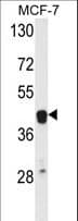 IHC-plus™ ETS2 Antibody (aa146-173)