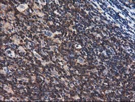 ADSL / Adenylosuccinate Lyase Antibody (clone OTI2D10)