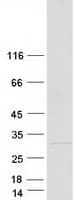 Human COMMD5 Protein (Recombinant Myc-DDK (Flag))