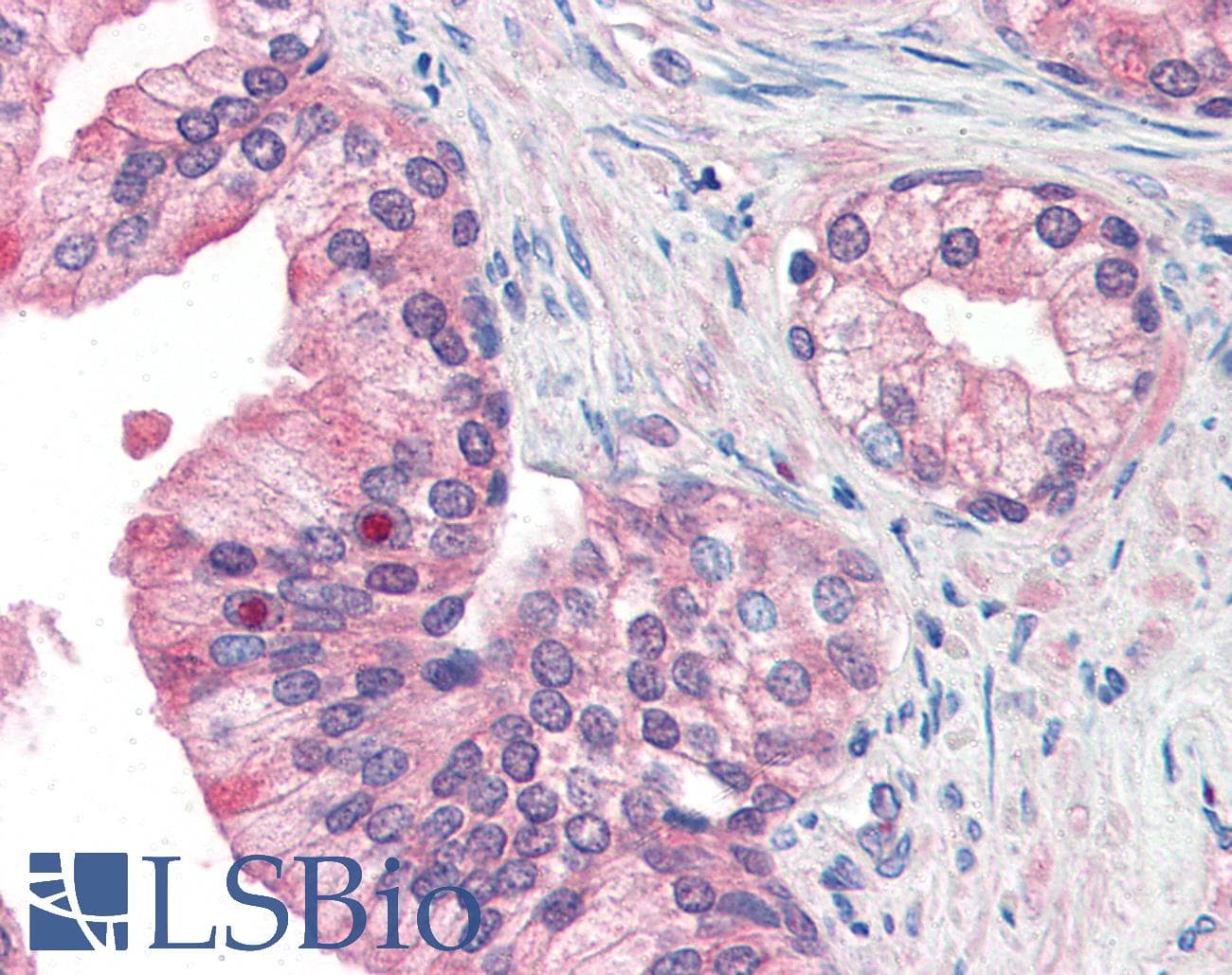 IHC-plus™ Polyclonal Rabbit anti-Human MFI2 / p97 Antibody (N-Terminus)