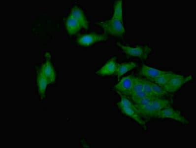 Polyclonal Rabbit anti-Human RARRES2 / Chemerin Antibody (aa21-157, IHC)