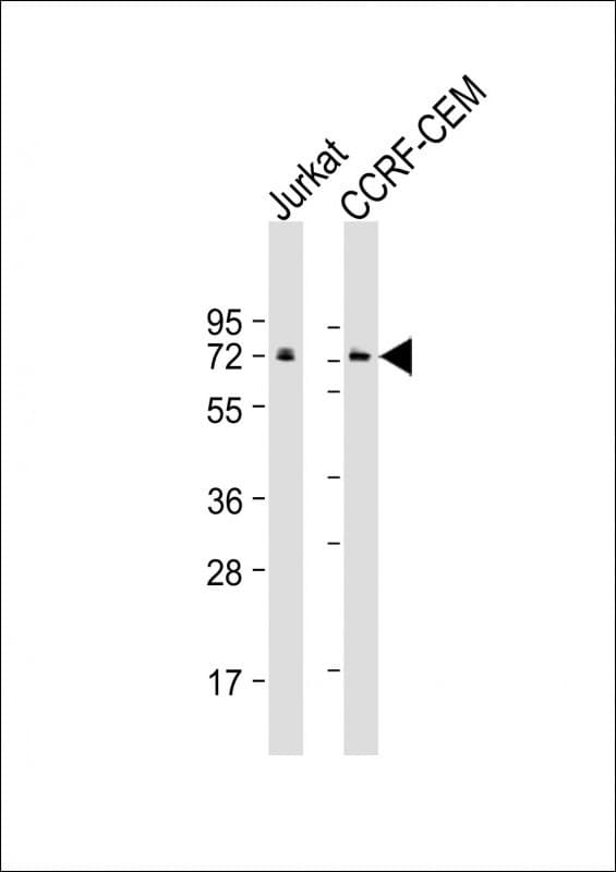 CBFA2T3 Antibody (clone 1719CT425.37.65)