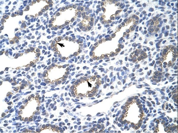KRT18 / CK18 / Cytokeratin 18 Antibody (N-Terminus)